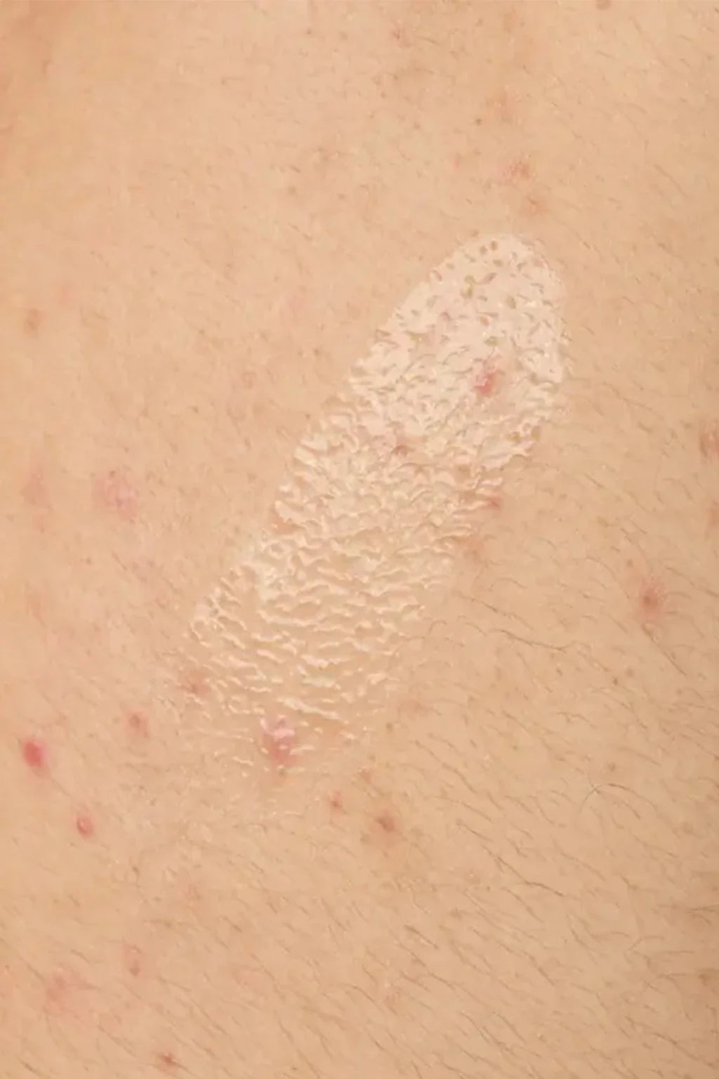The Ordinary Body Care Body Serum